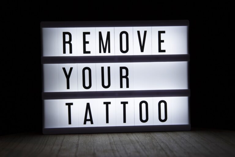 Veilig je tattoo verwijderen met een laserbehandeling